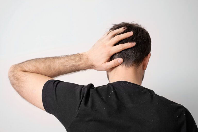 The Truth about Pain in Hair Transplant Procedures