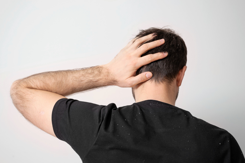 Pain in Hair Transplant Procedures