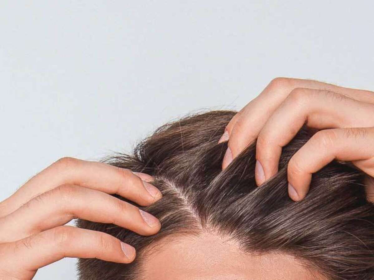 Itchy Scalp and Hair Loss